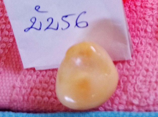 Ăn ốc phát hiện viên ngọc hình giống tượng Phật giá trị lớn